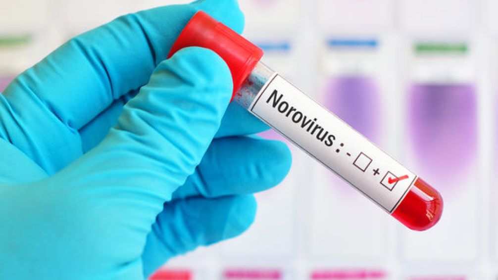 Alerta. El norovirus se hizo conocido luego de que afectara a varios jóvenes que se encontraban de viaje de egresados.