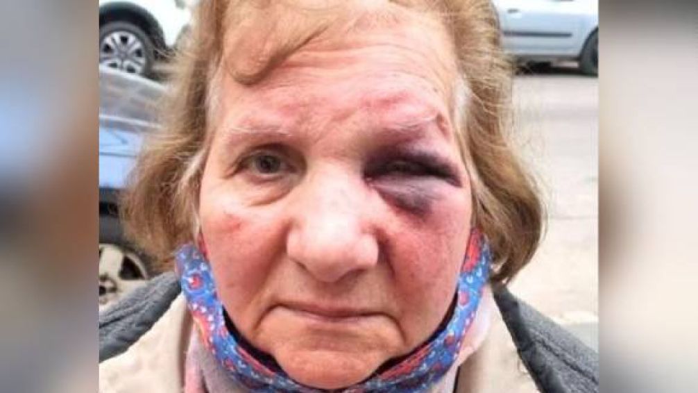 Brutalidad. Delincuentes golpearon a una anciana de 79 años en Lanús.