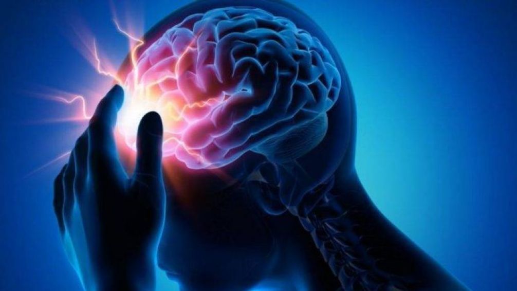 Día Mundial del Accidente Cerebrovascular: el 70% de los argentinos desconoce que hacer frente un ACV