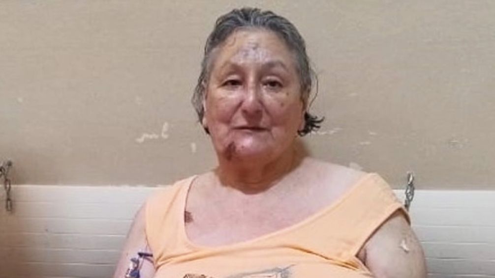 El testimonio de la sobreviviente del derrumbe en Villa Gesell: 'Empecé a utilizar técnicas de yoga para respirar mejor'