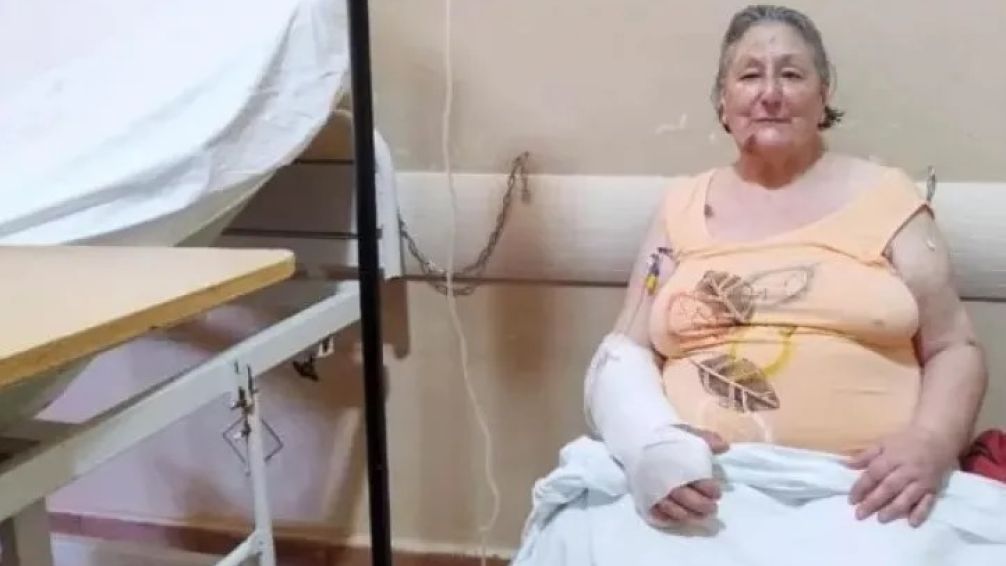 La jubilada fue trasladada hasta un hospital en Balcarce donde se recupera de las lesiones