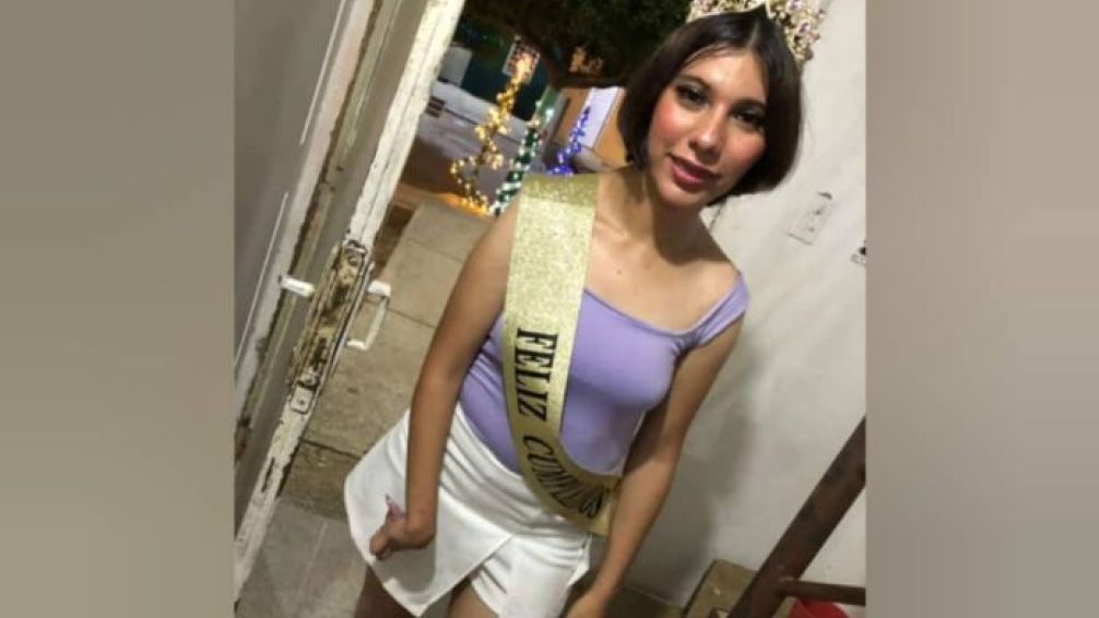 Muere quemada joven venezolana tras participar en reto de TikTok