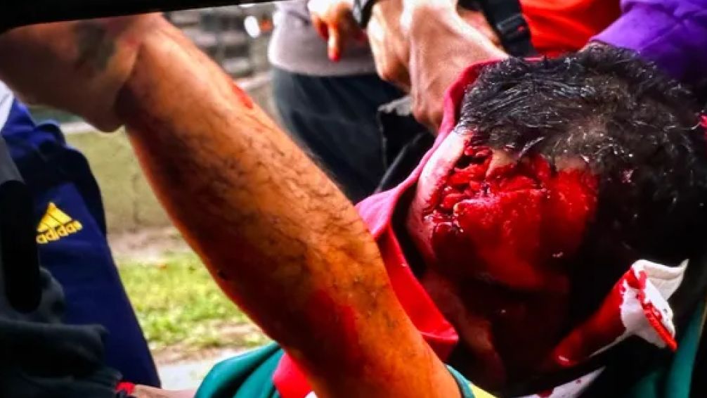 Pablo Grillo: ¿Quién es el fotógrafo herido durante la represión en el Congreso y qué dijo Patricia Bullrich?