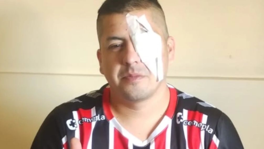 Represión en el Congreso: la policía le disparó y le destrozó un ojo