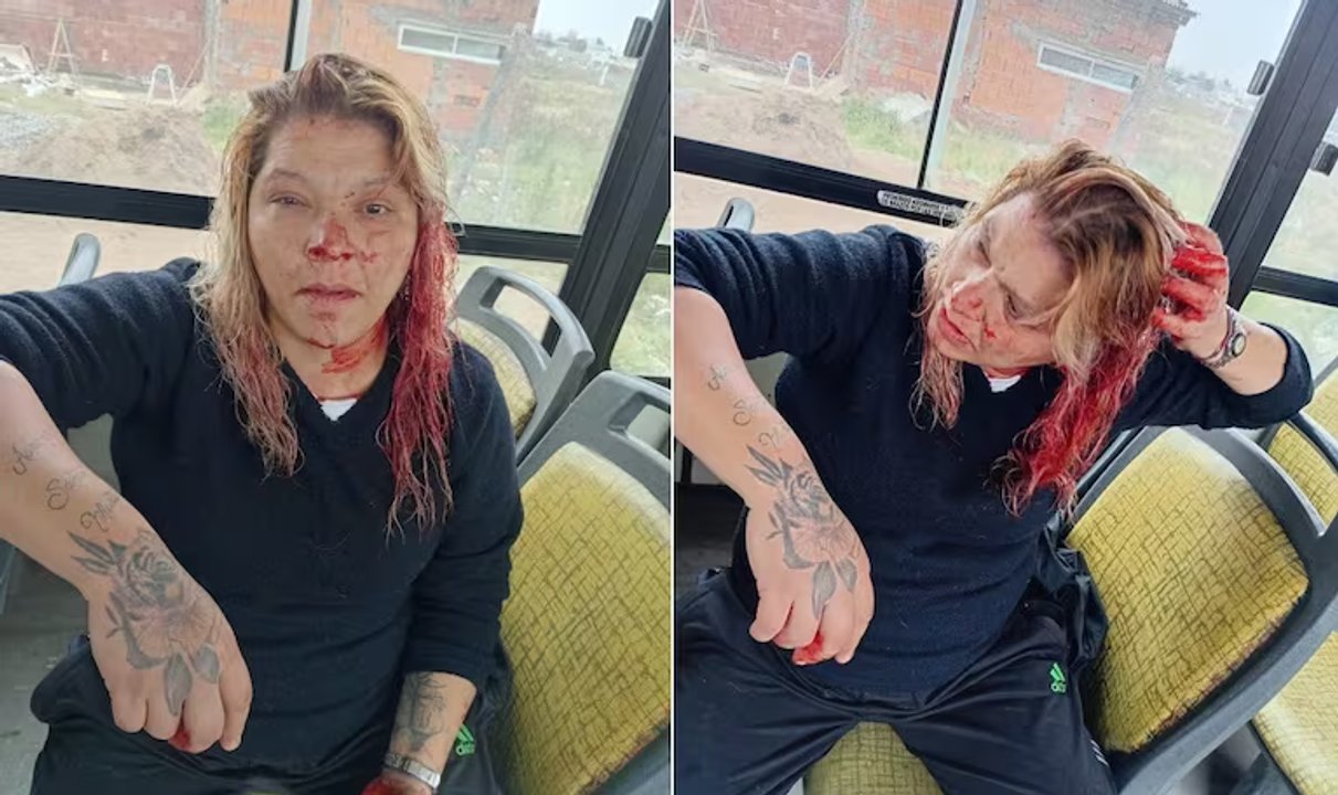 Bahía Blanca: la golpearon con un caño en la cabeza por no invitar a las chicas del barrio a los 15 de su hija