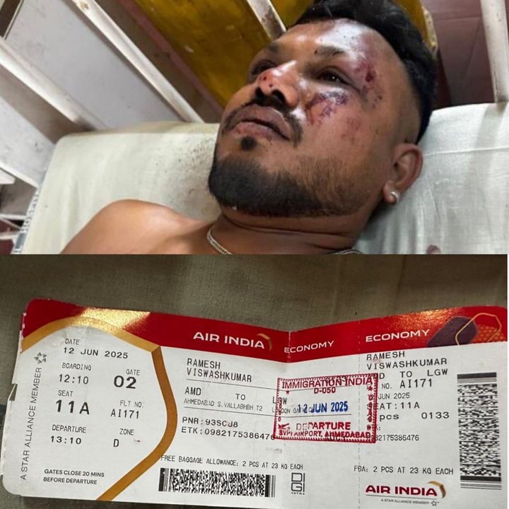Viswashkumar Ramesh, único sobreviviente del vuelo 171 de Air India: una historia de milagro y tragedia