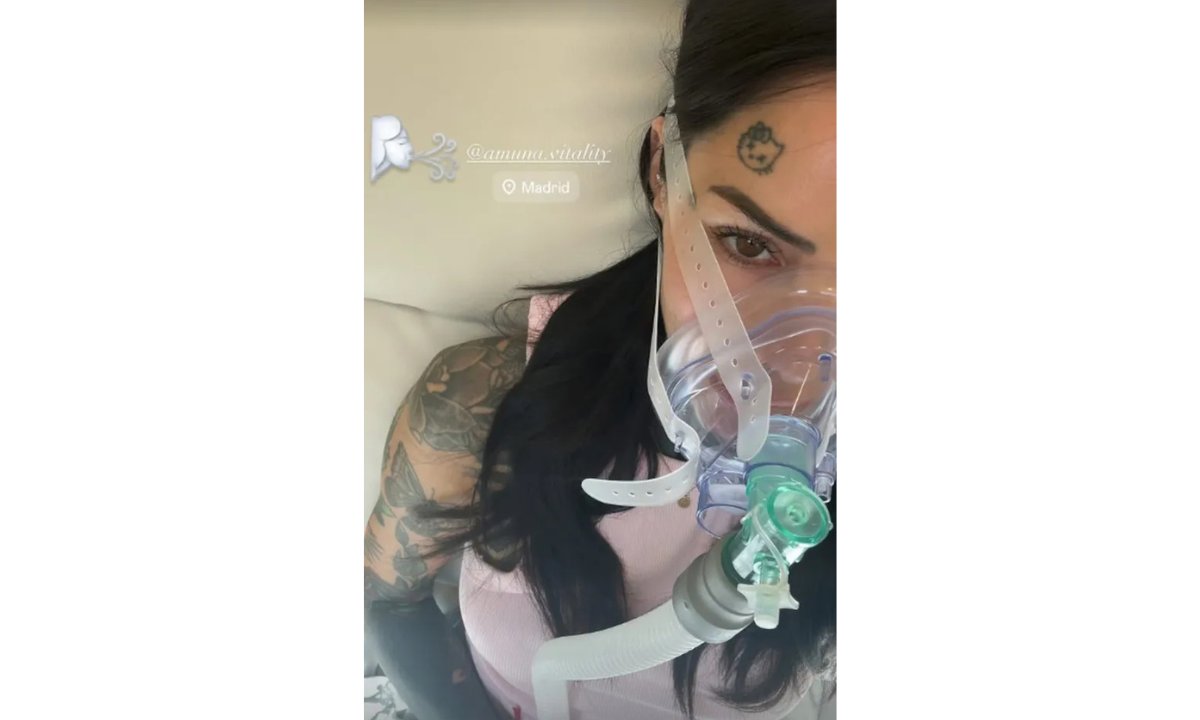 ¿Qué es la terapia de hipoxia intermitente que comenzó Cande Tinelli?