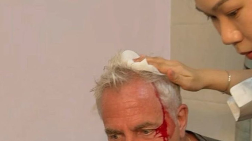 Marley se accidenta en Tailandia mientras grababa su programa
