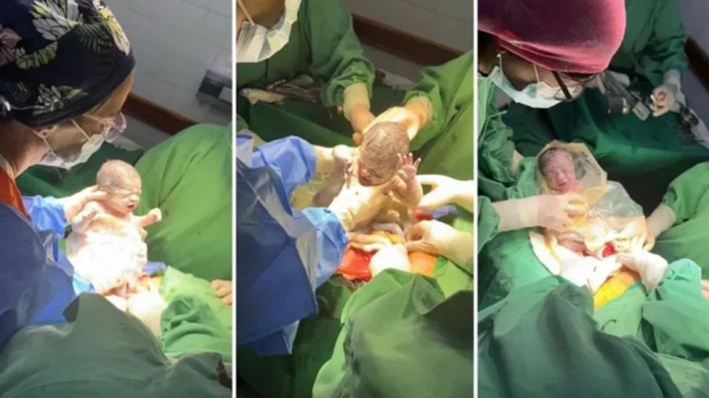 Un caso en un millón: Salta recibe a tres hermanas trigemelas