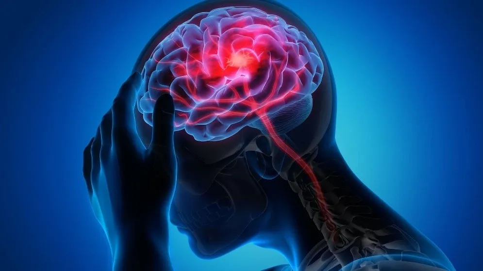 Avance científico: una nueva terapia con células madre podría reparar lesiones por derrame cerebral
